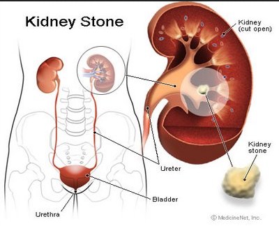 Chronic renal disorder (CKD) implies that your kidneys aren't 